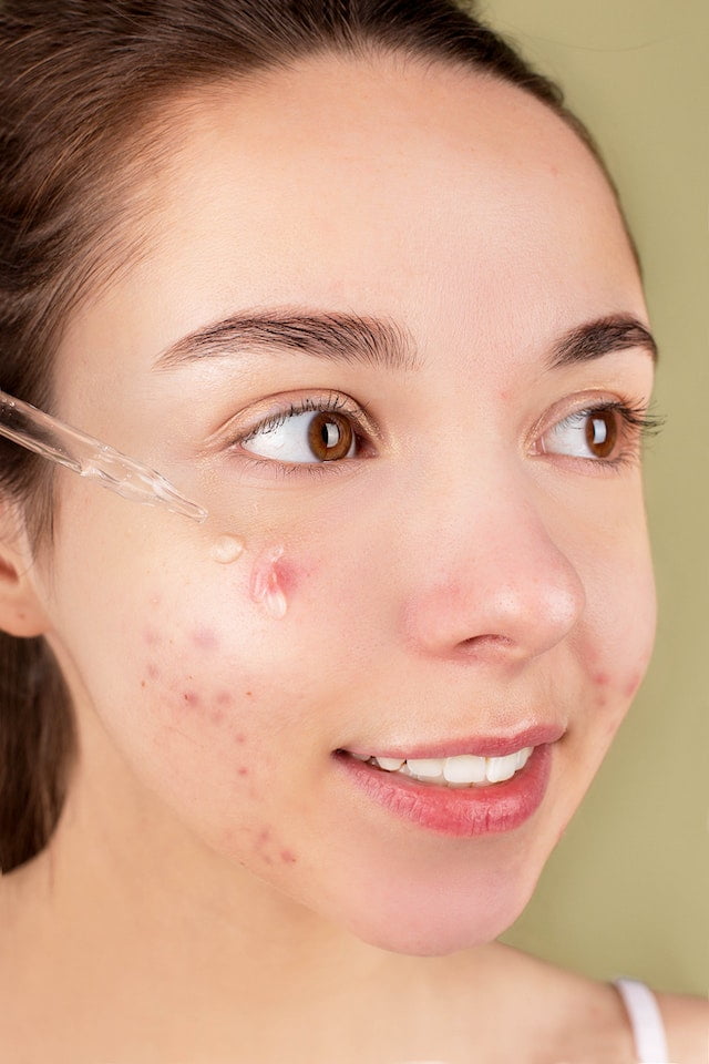 A woman is using a tool to get rid of acne on her face, following diet advice.
